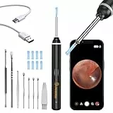VITCOCO Otoscopio Limpieza de Oídos, Qtoscopio Profesional 1920P Wifi, Limpia Oidos Cera Otoscopio con 6 LEDs, Limpia Oidos para iPhone, iPad y teléfonos inteligentes Android (Negro)
